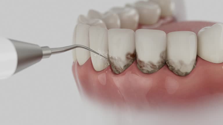 Reliable Dental contractor in Wye, MT by Dentist Open Now